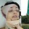 Felvették egy meztelen orosz nő halálát, aki egy útjelző táblán ütközött